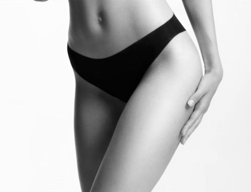 What Are the Different Types of Thigh Lift?