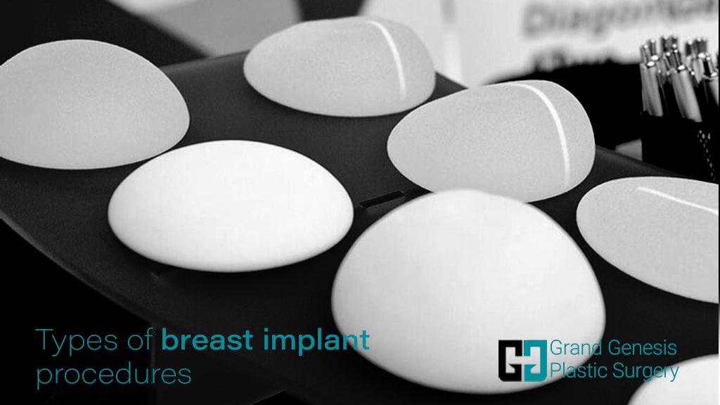 Breast prosthesis brands Clearance