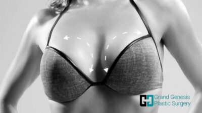 8-Benefits-of-Gummy-Bear-Breast-implant-min