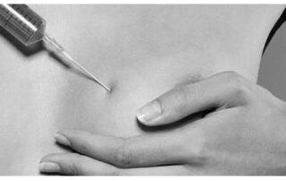 9-Breast-fat-transfer-The-benefits-of-breast-augmentation-with-fat-injections-mi
