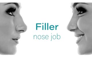 Filler nose job