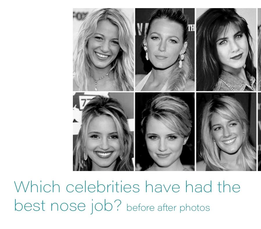 the best nose job of celebrities