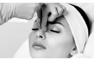 nonsurgical nose job