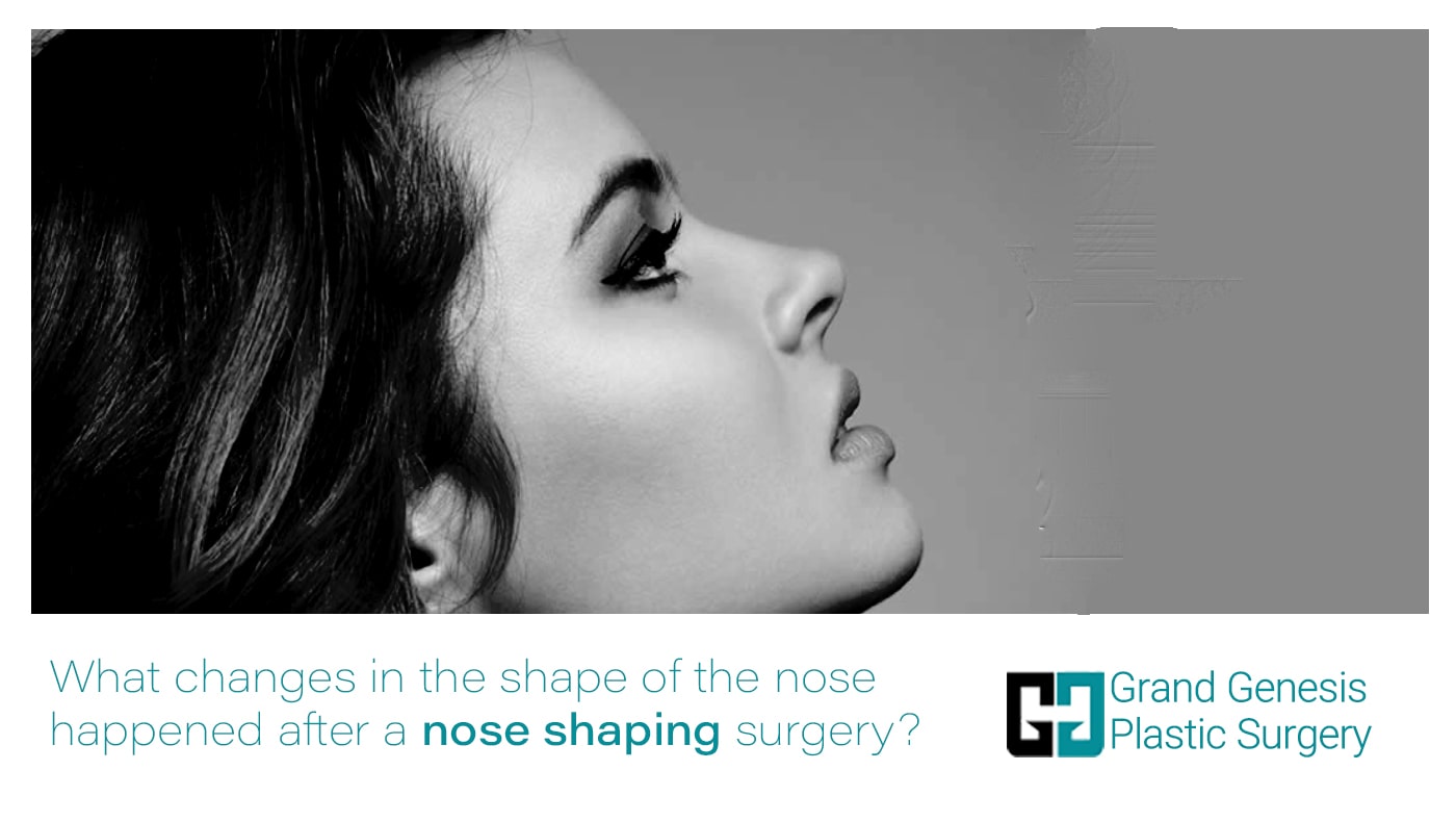 nose shaping