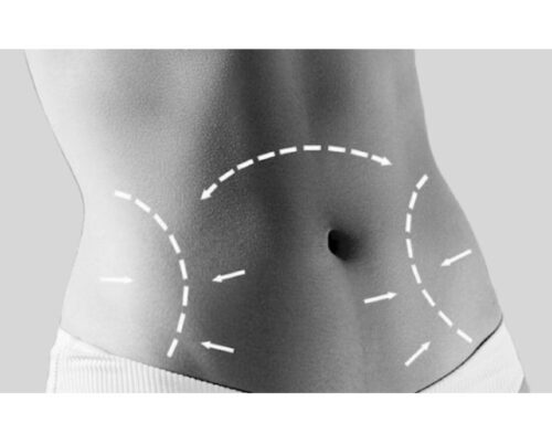 What is Tummy Tuck Surgery? | Complete Guide