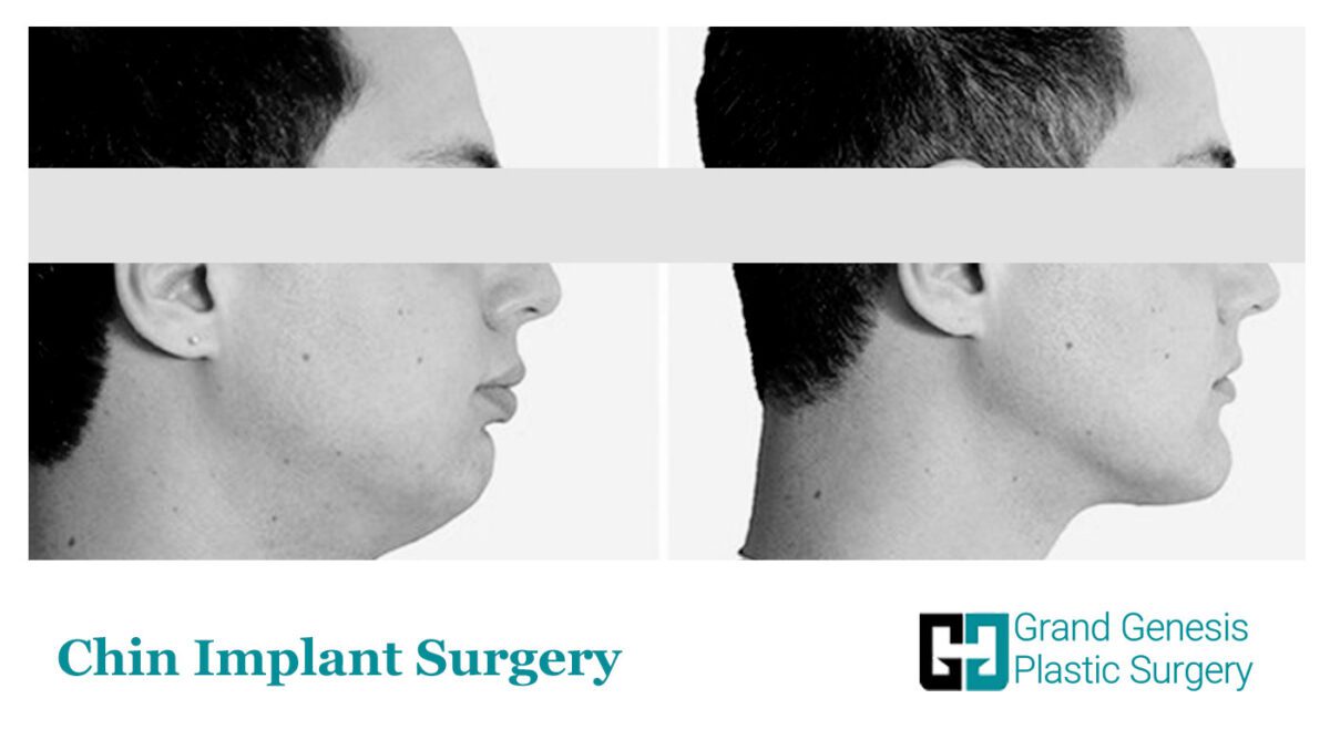 What Are The Face Contouring Surgery Procedures? GRAND GENESIS