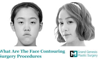 face contouring