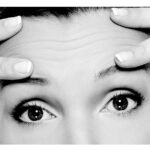brow lift surgery