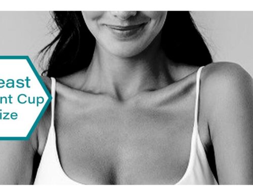 Breast Implant Cup Size | How to Choose Cup Size for Breast Augmentation?