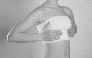 breast lift scars