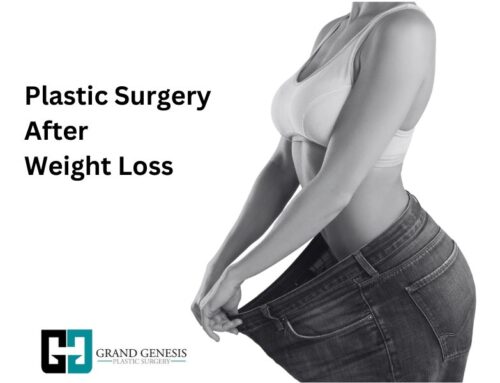 Plastic Surgery After Weight Loss in Toronto and GTA