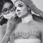 Is plastic surgery painful