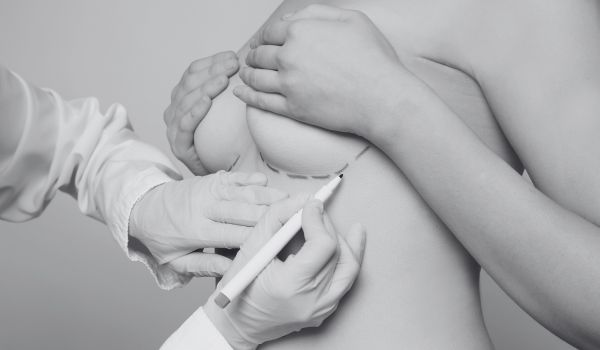 Does plastic surgery last a lifetime?