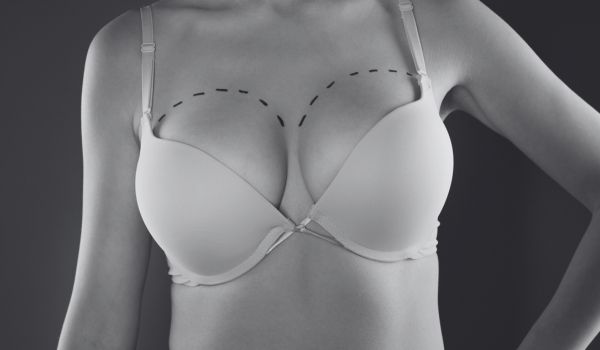 breast lift cost in toronto 