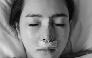 Protecting Your Nose After Rhinoplasty