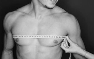 Gynecomastia-vs.-Chest-Fat