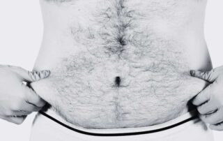 Male Liposuction