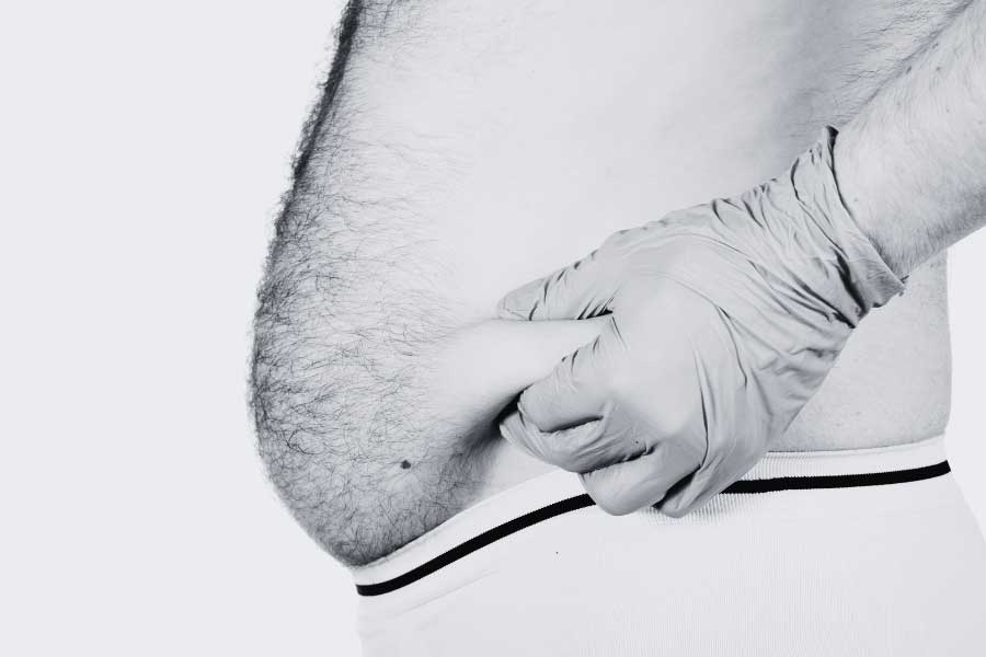 is male liposuction worth it