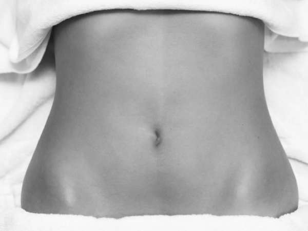 Recovery time after tummy tuck