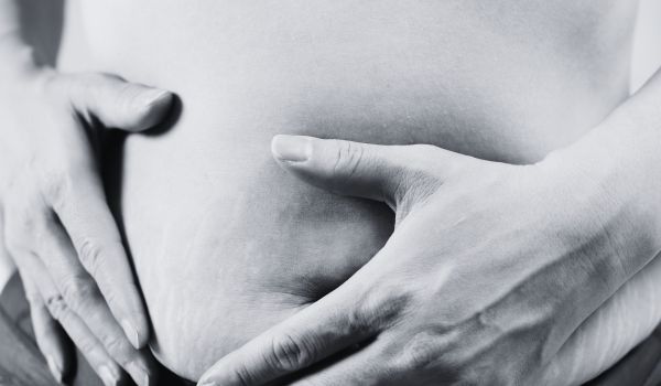 Why Do Stretch Marks Appear on the Stomach?