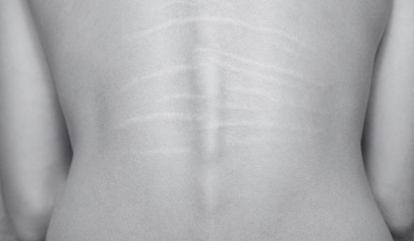 Why Choose GGPS for Intragastric Treatments?