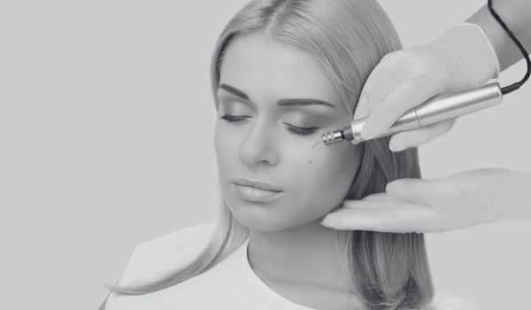 Non-Surgical Alternatives: Botox & Fillers