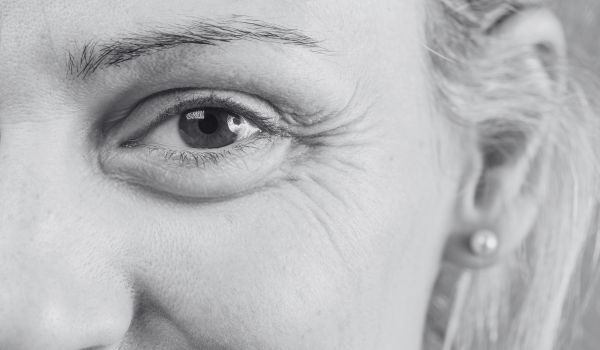 Understanding Eyelid Aging: Why Wrinkles & Puffiness Occur