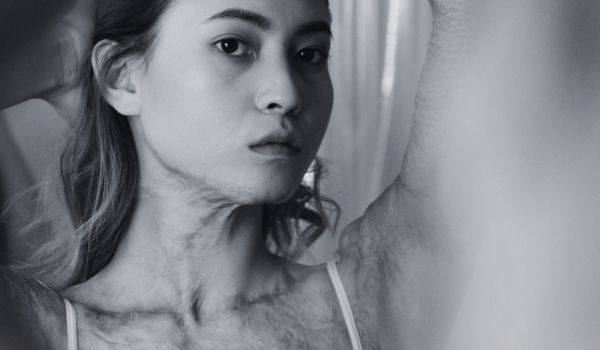 What Types of Scars Can Be Revised?